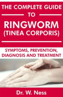 The_Complete_Guide_to_Ringworm__Tinea_Corporis___Symptoms__Prevention__Diagnosis_and_Treatment